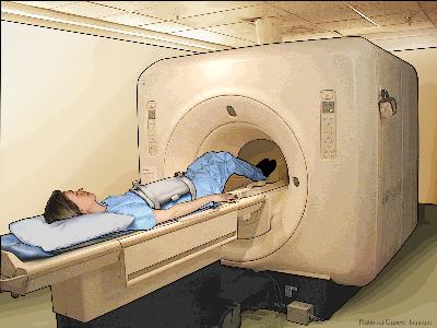Magnetic resonance imaging (MRI) of the abdomen. The patient lies on a table that slides into the MRI machine, which takes pictures of the inside of the body. The pad on the patient’s abdomen helps make the pictures clearer. Magnetic resonance imaging (MRI) of the abdomen; drawing shows the patient on a table that slides into the MRI machine, which takes pictures of the inside of the body. The pad on the patient’s abdomen helps make the pictures clearer.