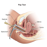 Illustration of a pap test procedure