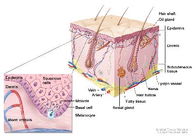 Anatomy of the skin with melanocytes; drawing shows normal skin anatomy, including the epidermis, dermis, hair follicles, sweat glands, hair shafts, veins, arteries, fatty tissue, nerves, lymph vessels, oil glands, and subcutaneous tissue. The pullout shows a close-up of the squamous cell and basal cell layers of the epidermis above the dermis with blood vessels. Melanin is shown in the cells. A melanocyte is shown in the layer of basal cells at the deepest part of the epidermis. 
