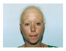 woman without wig