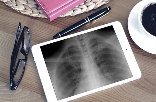 X-ray displayed on iPad.