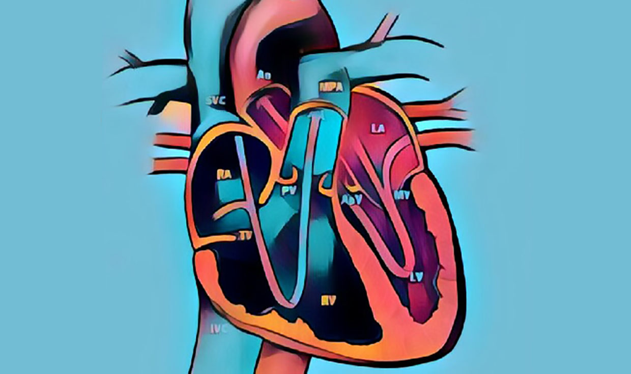 CABG heart illustration