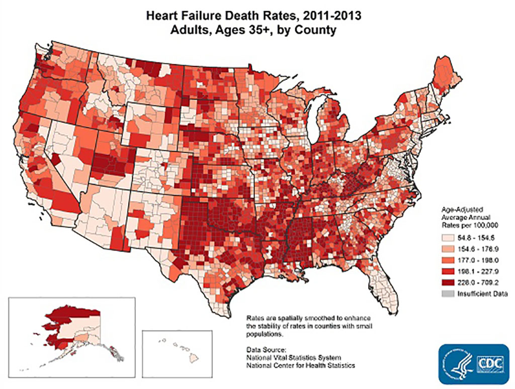 Map of the U.S. showing cases of heart failure by county