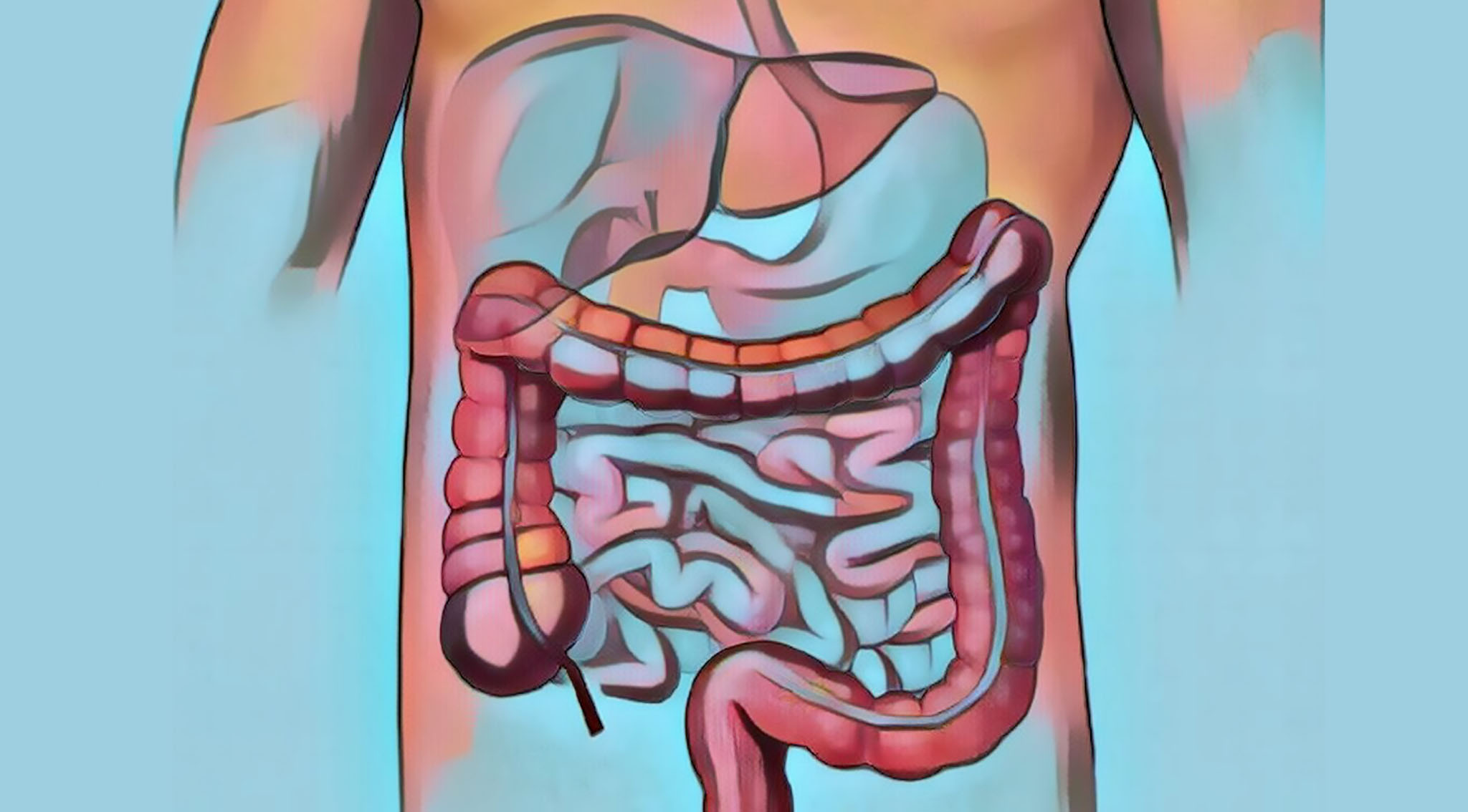 Irritable bowel syndrome artist rendering