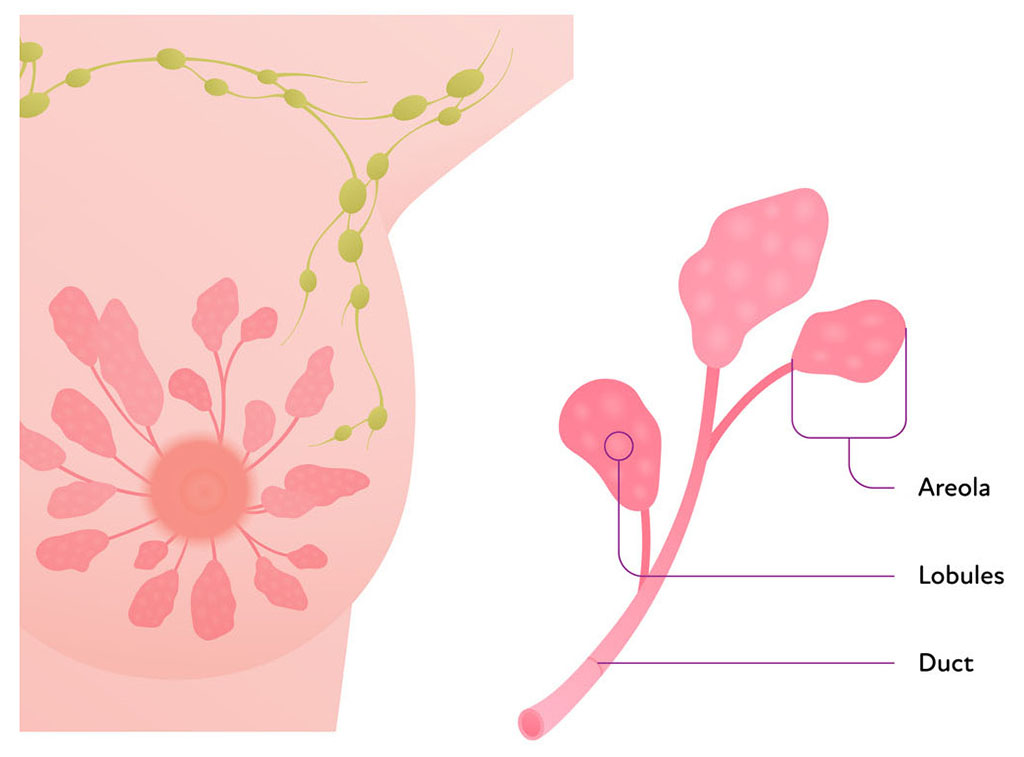 Illustration showing the areola, lobules and duct in a breast.