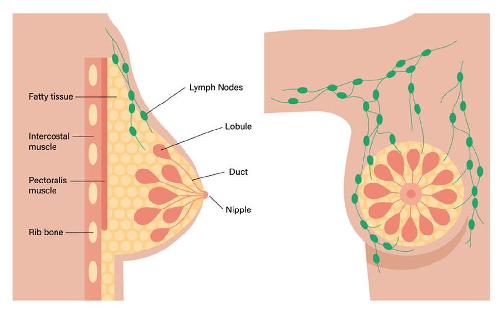 Illustration showing areas of the breast including lobule, duct, nipple and lymph nodes.