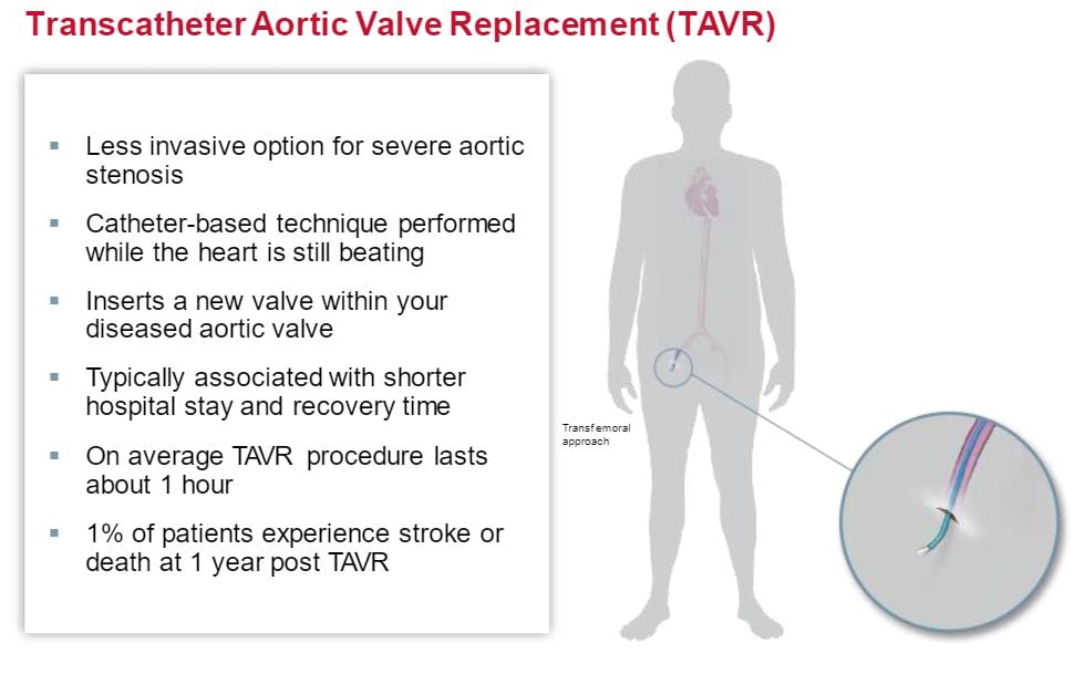 TAVR infographic.