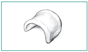 Pessary Cystocele - Pessary