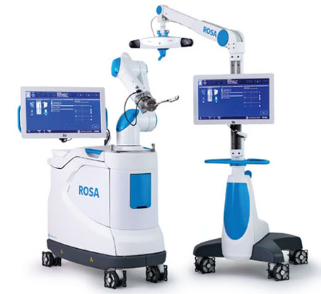 Rosa robotic knee replacement surgery system.