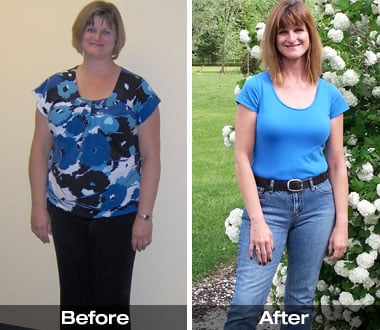 Tamara B. before and after photos, gastric bypass surgery.