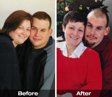 Brian and Jennifer H. before and after weight loss surgery.