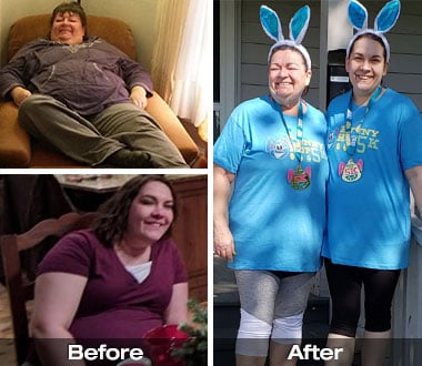 Deb and Megg before and after bariatric surgery.