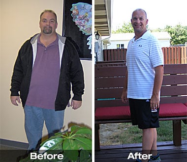 Earl S. before and after bariatric sleeve surgery.