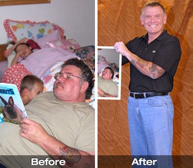 Joe D. before and after weight loss surgery.