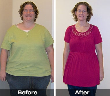 Karla B. before and after weight loss surgery.
