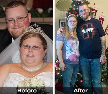 Matt and Sandra H. before and after gastric sleeve surgery.