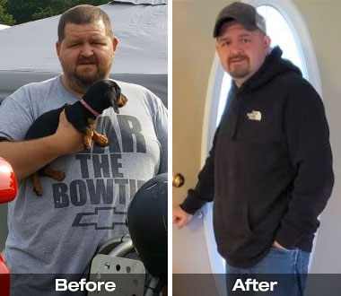 Paul M. before and after medically supervised weight loss and bariatric surgery.