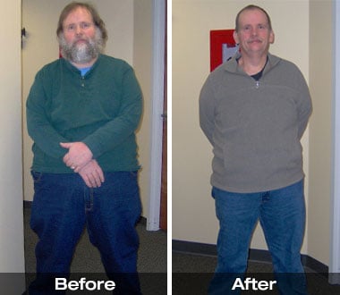 Richard L. before and after gastric sleeve surgery.