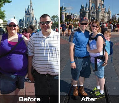 Sara and Stephen before and after bariatric surgery.