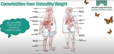 Medically Supervised Weight Loss video thumbnail